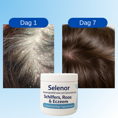 Hoofdhuid herstellende balsem™