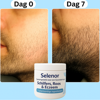 Baardhuid herstellende balsem™